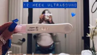 12 WEEK ULTRASOUND | GENDER CONFIRMED