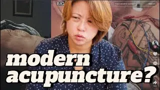 Doctor Explains: Is Your Acupuncture Causing More Harm Than Good? | Modern Acupuncture Insights