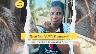 Lice And Nits Treatment in Our Service Tamilnadu | #headlice #lice #nits #hair #hairstyle #youtube 