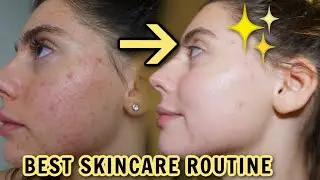 MY UPDATED SKINCARE ROUTINE FOR ACNE SCARS, CLEAR SKIN 2021!!