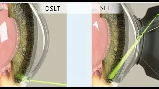 DSLT Energy Explainer