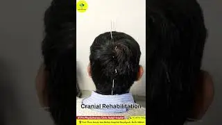 A Journey through Cranial Rehabilitation for Optimal Brain  #physiotherapy #shorts