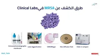 طرق الكشف عن Methicillin resistant staphylococcus aureus MRSA في Clinical Labs