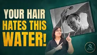 The Hidden Dangers of Hard Water on Hair Fall | Hindi