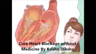 Cure Heart Blockage without Medicine By Krishn Diksha
