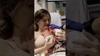 newborn twins first hug 🥹🥹