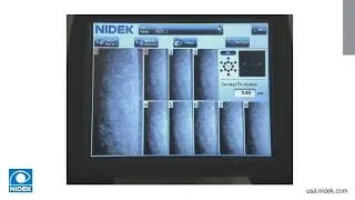 NIDEK CEM-530 Specular Microscope | Product Training