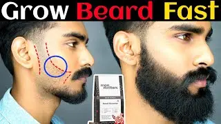 Man Matters Beard Gummy Review After 3 Months | man matters beard gummy review | beard gummy