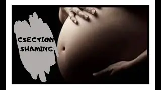 C-SECTION SHAMING | Birth Shaming | Birth Stigma