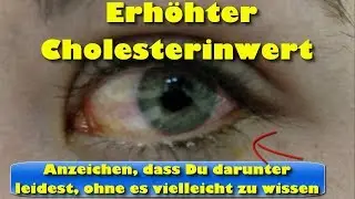 Erh&ouml;hter Cholesterinwert &ndash; Anzeichen, dass Du darunter leidest, ohne es vielleicht zu wissen