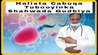 Caabuqa Waxyeleya Tuboyinka Shahwada Qaada, waxyabaha kena,  Calamadaha Lagu garta & Sida Lo Daaweyo