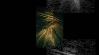 Teaser Shortwave Radio Frequencies