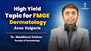 High-Yield FMGE Dermatology | Acne Vulgaris (Diagnosis + Treatment MCQs)