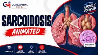 Sarcoidosis Animation  High-Yield Internal Medicine for NEET PG/FMGE/USMLE