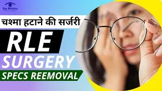 RLE surgery: Meaning, Procedure, Advantages & Disadvantages