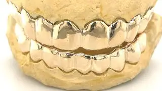 10 top 10 bottom gold grillz by Seattle Gold Grills