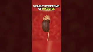 Early 5 signs and symptoms of diabetes #diabetes