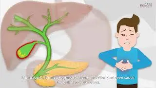 Gallstones 101 - Not A Normal Gastric Pain | GUTCARE