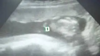reto&ntilde;ito ya naceras.wmv