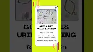 Guess this Urine Finding #4 | Urinalysis Review