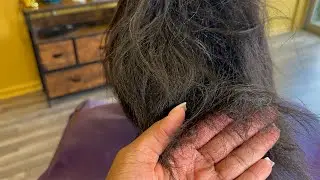 Relaxer broke her hair off| How we fixed her damaged hair pt2