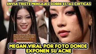 Megan from Katseye goes viral for photo exposing her acne + sends a sad message about the criticism