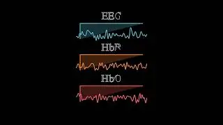 Animated voting classifier system