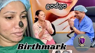 Facial Birthmark උපන් ලප Successful surgical removal by  Dr Ananda Jayawardena Plastic Cosmetic