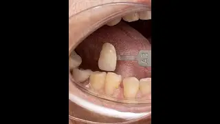 Clinical Photography Dental course introduction