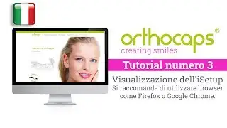 Orthocaps Tutorials, visualizzazione dell&rsquo;iSetup.