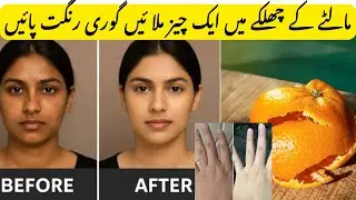Get Brighter Skin in Just 8 Days | Easy HomemadeRemedy|skin remedy by aajkiyapakayen |