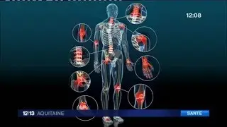 Quels solutions pour soulager les douleurs li&eacute;es &agrave; l'arthrose ?