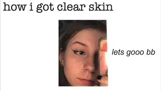 how i got clear skin in 2020