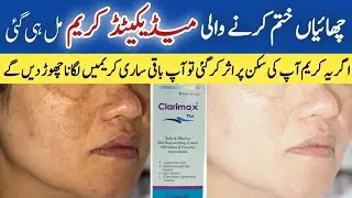 Clarimax plus cream review and side effects||Medicated cream for skin white ||pigmentation cream