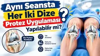 Aynı Seansta Her İki Dize Protez Uygulaması Yapılabilir mi? | Prof. Dr. Yakup YILDIRIM