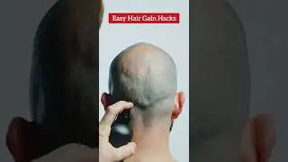 Easy hair gain hacks funny video #ytshorts #viral #trending #hairgainhacks #hairfallsolution #funny