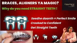 Straight Teeth Benefits | Braces and Aligners #straightteeth  #bracesvsaligners  #orthodontics