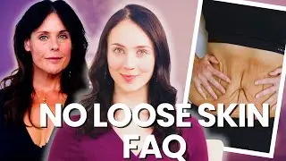 160 Pounds Lost Naturally | The Loose Skin Question Answered