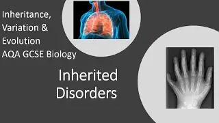 Part 4 Inherited Disorders & Genetic Screening