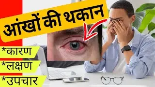Expert Optometrist Reveals Shocking Truth About Digital Eye Strain