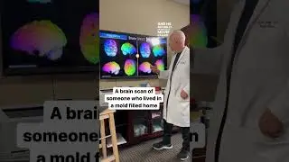 Mold vs. The Brain 🦠 🧠
