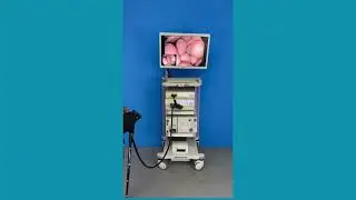 Olympus Evis Exera II CV 180 Endoscopy System with GIF Q180 & CF H180AL TESTING VIDEO