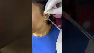 #piercing #youtubeshorts #subscribe #like #viralvideo #video #viralshort #girlpinching #bodypiercing