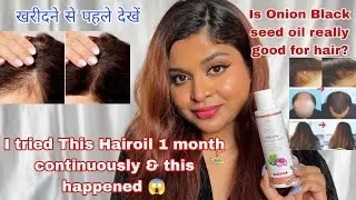 7Days Organic Onion Black seed Hair Oil for Hair Growth || How to use Onion Black seed hair oil