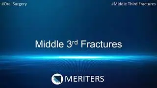 NEET MDS | INI-CET | Oral Surgery | Middle 3rd Fracture | MERITERS