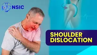Shoulder Dislocation Explained | Causes, Symptoms & Treatment | Dr. Aditya Sharma | NSIC Noida