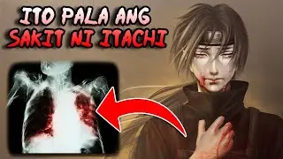 Ang Misteryosong sakit ni Uchiha Itachi || Naruto Tagalog Analysis || @AnimeTagalogTalakayan