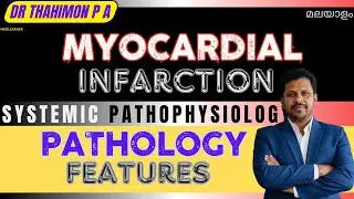 Myocardial Infarction Malayalam Pathology Types  ECG Changes Heart Attack Malayalam Symptoms 
