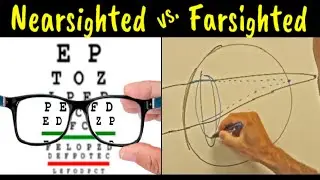 Myopia vs. Hyperopia vs. Presbyopia | Difference Explained