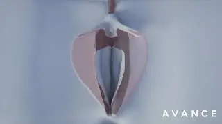 Vaginal Rejuvenation Dr. Erez Dayan Avance Plastic Surgery